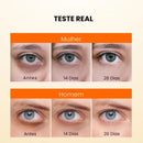 Creme Anti Olheiras e Rugas 20% De Vitamina C - Pele Clara e Rejuvenescida JoyPretty