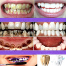 Clareador Dental Cream V34