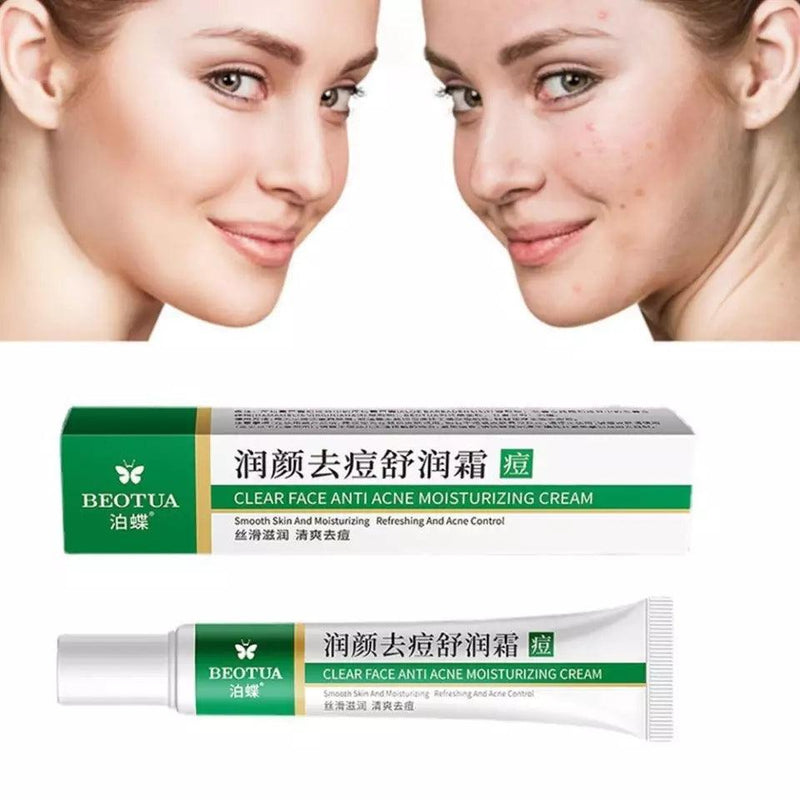 Creme Removedor de Espinhas™ - Limpeza Profunda Perfect Face