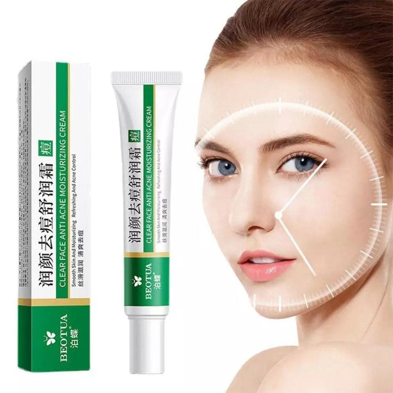 Creme Removedor de Espinhas™ - Limpeza Profunda Perfect Face