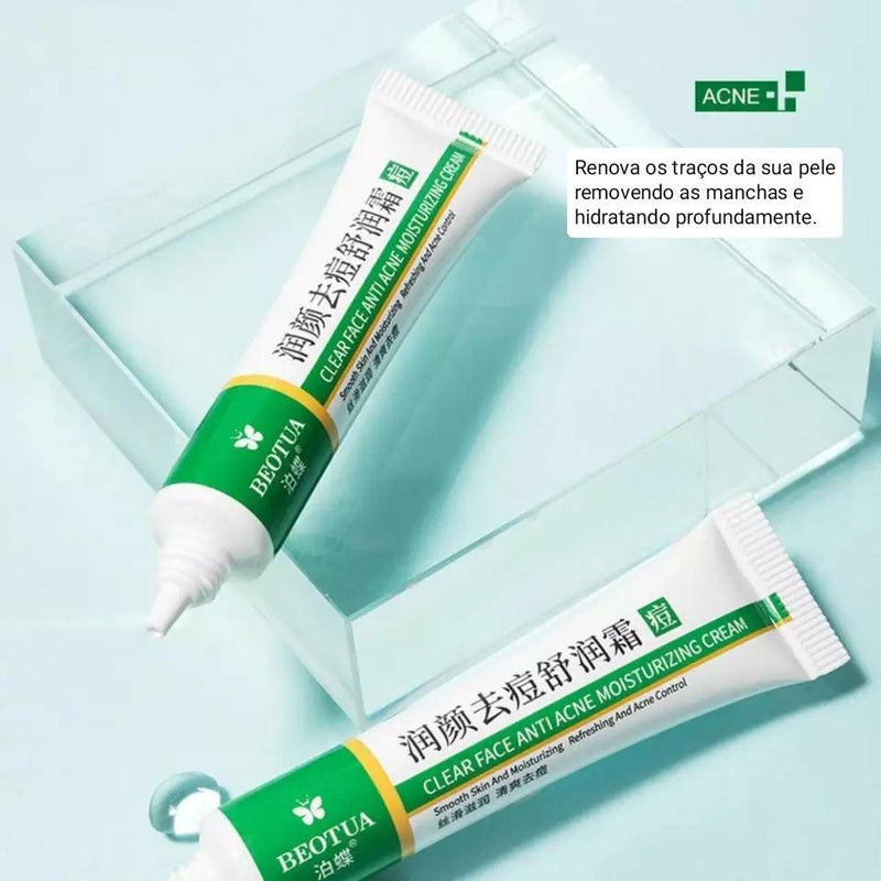 Creme Removedor de Espinhas™ - Limpeza Profunda Perfect Face