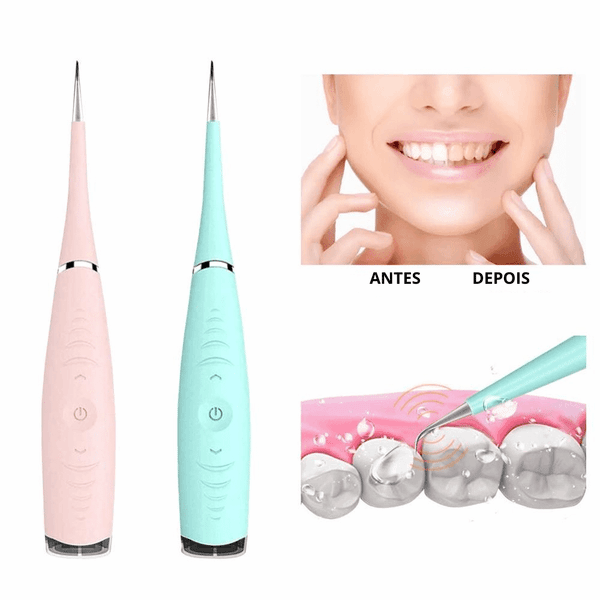 Removedor De Tártaro E Placas Bacterianas Tooth Cleaner - Limpador Dental